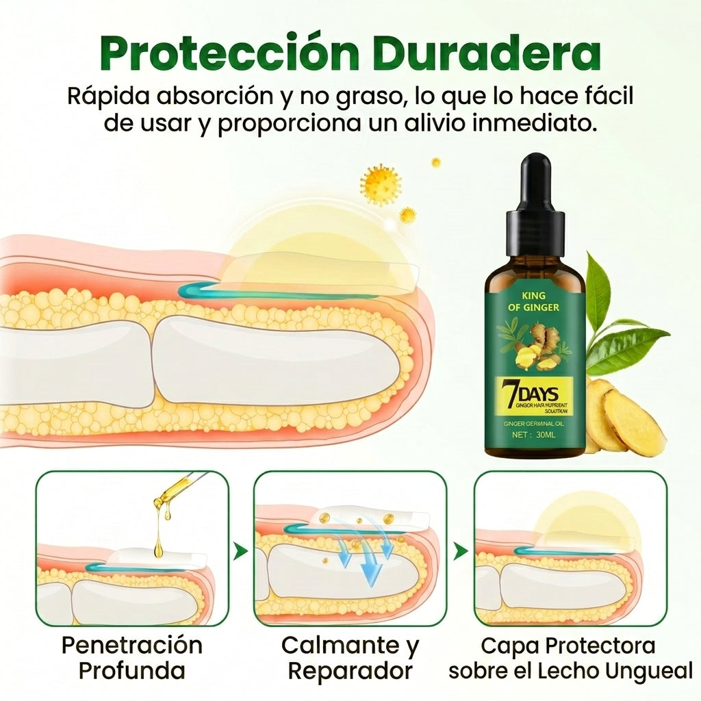 7Days™ Tratamiento Anti Hongos - Elimina Uñas Amarillas y las Fortalece desde 7 Días