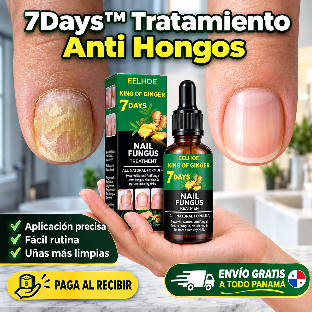 7Days™ Tratamiento Anti Hongos - Elimina Uñas Amarillas y las Fortalece desde 7 Días